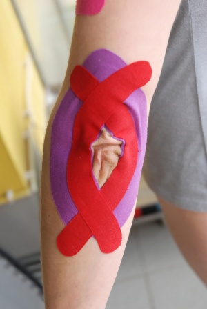 KINEZIOTAPING