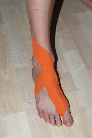 KINEZIOTAPING
