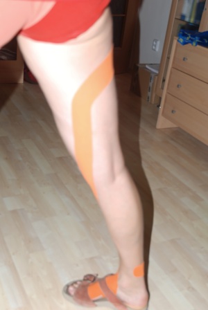 KINEZIOTAPING